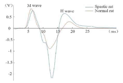 The H-reflex EMG signal of spastic and normal rats. | Download Scientific Diagram