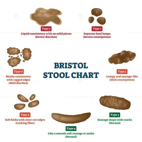 What Causes Your Stool To Be Stringy at Diane Hamilton blog