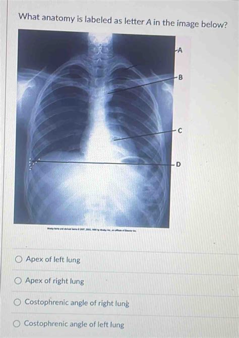 Solved: What anatomy is labeled as letter A in the image below? Apex of left lung Apex of right ...