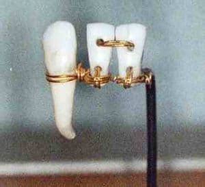 Ancient Egyptian Dentistry - DentalSave Dental Plans