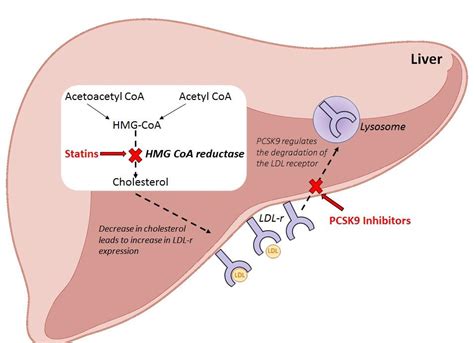 The development of a new service for patients with hyperlipidaemia and ischaemic heart disease