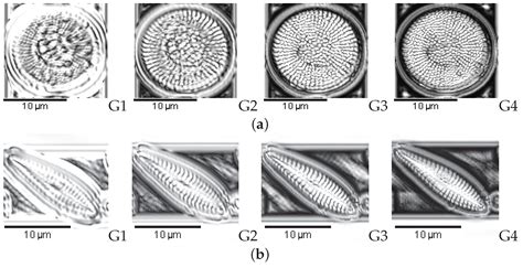 Applied Sciences | Free Full-Text | Automated Diatom Classification ...