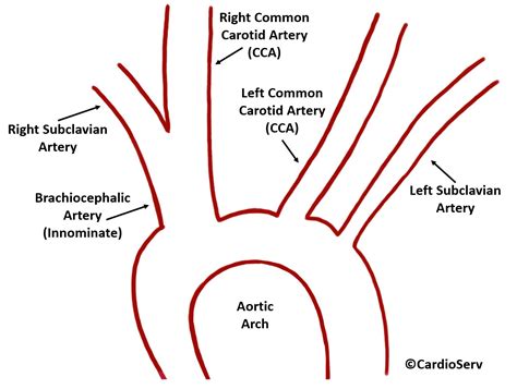 Carotid Artery Anatomy Cardioserv