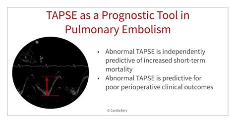 Learn the role echo plays after a patient has been diagnosed with PE. This week we review TAPSE ...