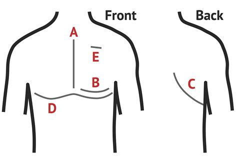 Thoracic Scars | Cardio Exam - MedSchool