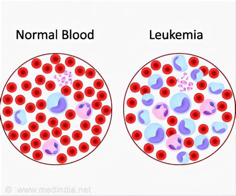 People Who Have Cll