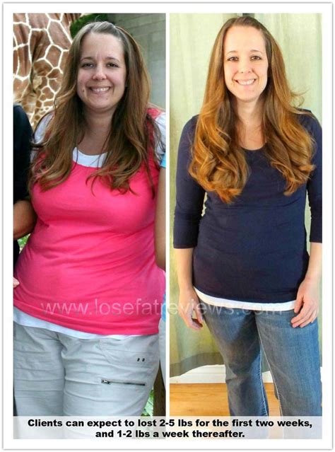 Good Looking After Weight Loss – Image