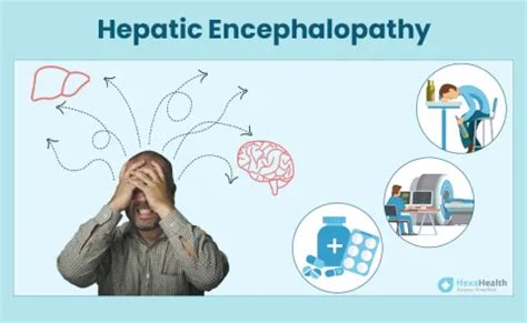 Hepatic Encephalopathy Pathophysiology, Triggers, Signs, 43% OFF