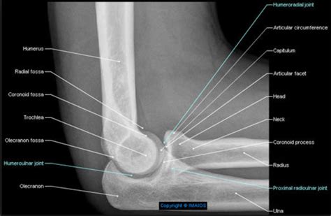 Lateromedial projection /Lateral Position ELBOW | Radiology, Radiology ...