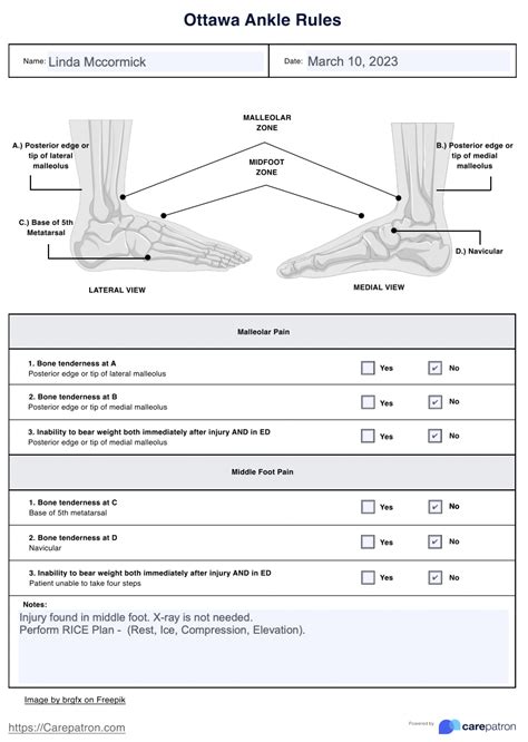 Ottawa Ankle Rules & Example | Free PDF Download