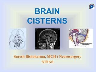 Basal Cisterns Anatomy