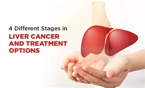 4 Different Stages in Liver Cancer and Treatment Options | PSRI Hospital