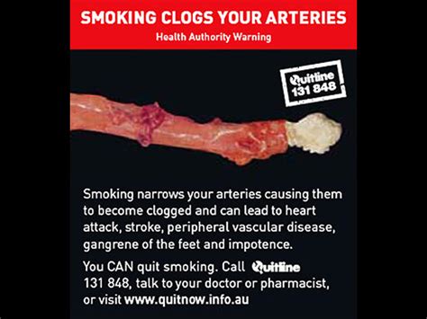 Australia's graphic tobacco warning labels - Photo 1 - CBS News