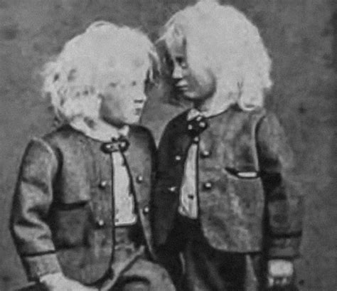 Twisted Facts About the Muse Brothers, The Heartbreaking Circus Act - Factinate