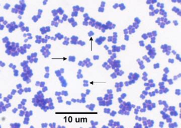 Micrococcus luteus | KÖRnyezetvédelmi INFOrmáció