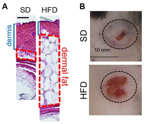 Research identifies obesity and infection link