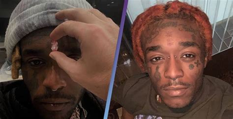 Rapper Lil Uzi Vert Shares Video Of $24 Million Pink Diamond Implanted In His Forehead