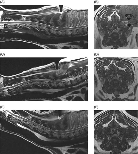 What Is Wobblers Disease In Dogs