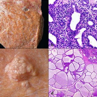 (PDF) Pathological and microbiological characterization of mastitis in dairy cows