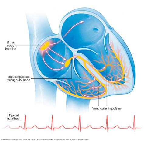 Sick sinus syndrome Disease Reference Guide - Drugs.com