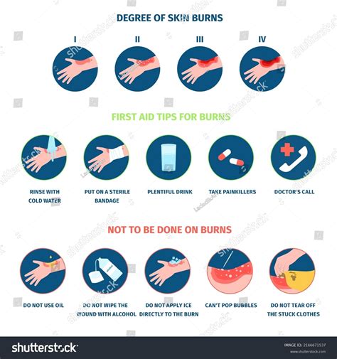 Skin Burn Stages Infographics Treatment Thermal Stock Vector (Royalty ...