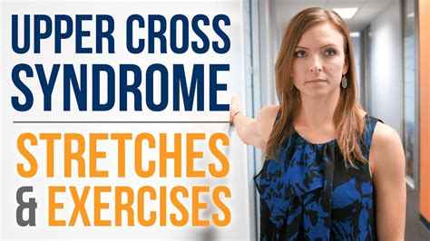 Upper Cross Syndrome Exercises Pdf - Captions Update Trendy