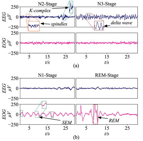 Salient waves in EEG and EOG signals. (a) Spindle wave and K-complex... | Download Scientific ...