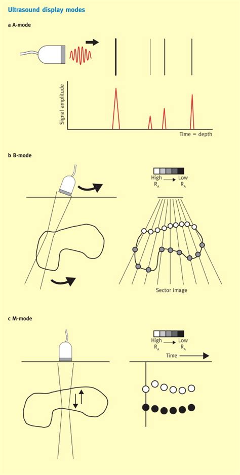 The physics of ultrasound - Anaesthesia & Intensive Care Medicine