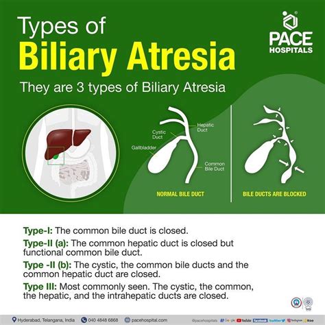 Biliary Atresia Causes Symptoms Prognosis And Biliary Atresia Treatment | Hot Sex Picture