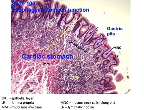 Hsitology - Esophagus - Stomach Junction and Gastric Pits - Histology | Lymphatic nodules ...