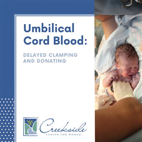 Umbilical Cord Blood: Delayed Clamping and Donating - Creekside Center For Women