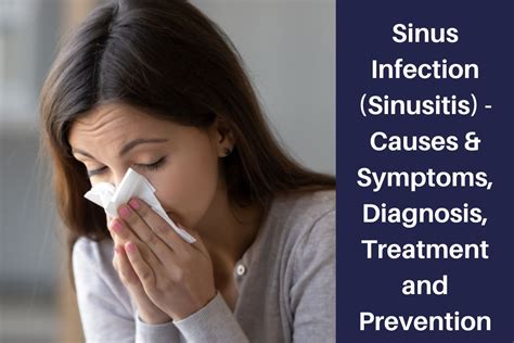 Sinus Infection (Sinusitis) - Causes & Symptoms, Diagnosis, Treatment and Prevention ...