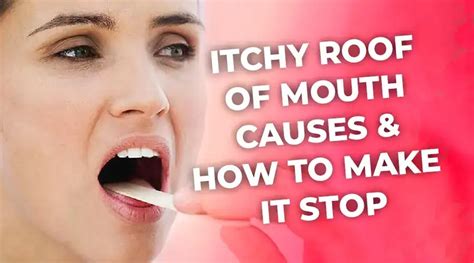 Itchy Roof of Mouth: Causes & How to Make It Stop