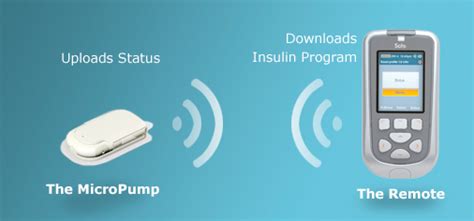 Roche Acquires Medingo Solo Insulin Patch Pump