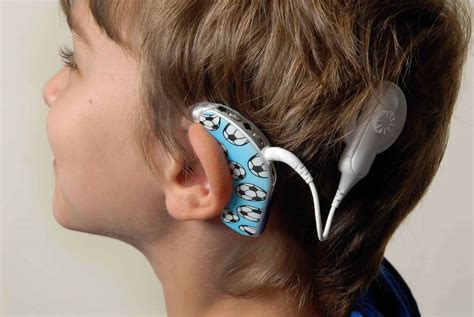 Cochlear implant function, surgery and cochlear implant pros and cons