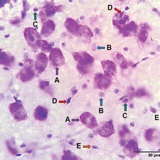 Neurons, glial cell types, and endothelial cells in a cresyl violet... | Download Scientific Diagram