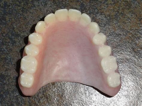 Full Upper Denture .. Real False Teeth ..Denture Study