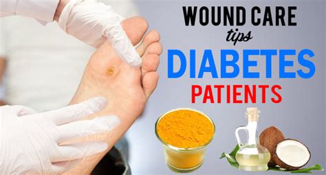 Wound Care Tips For Diabetes Patients - Remedies Lore