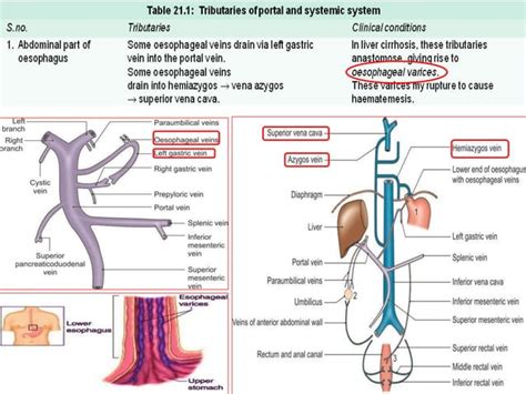 Portal vein & portocaval anastomosis | PPT