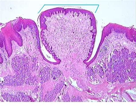 Papillae Histology Flashcards | Quizlet