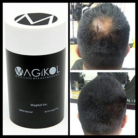 Buy THE BEST RATED 100% Vegan + Natural Hair Loss for Men & Women - 100% Money-Back Guarantee ...