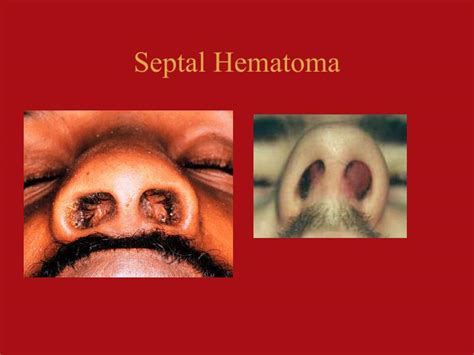 PPT - Physical Diagnosis in Otolaryngology Department of Otolaryngology, Head & Neck Surgery ...