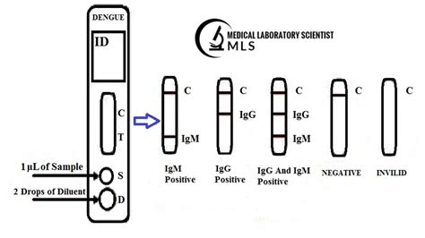 Dengue IgG / IgM Rapid Diagnostic Test | Lab Tests Guide