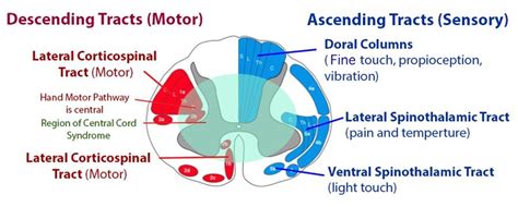 Incomplete Spinal Cord Injuries - Spine - Orthobullets