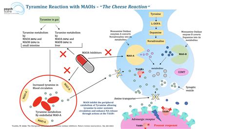 Wellbutrin Monoamine Oxidase Inhibitor