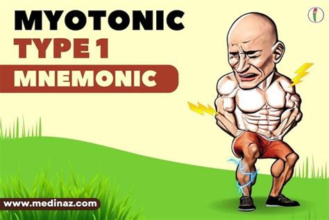 Myotonic dystrophy type 1 Mnemonic - Medinaz Blog