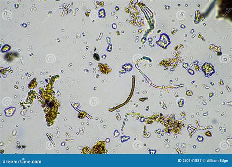 Fungal and Fungi Hyphae Under the Microscope in the Soil and Compost ...