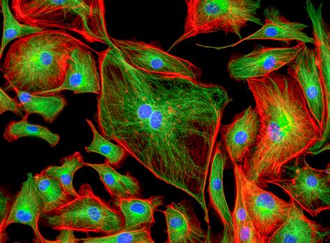 Endothelial Colony Forming Cells in PAH Restore Myocardial Vascular ...