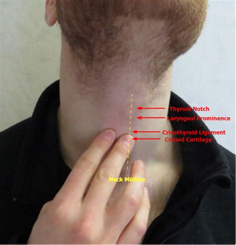 Thyroid Lump In Throat