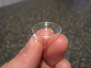 Patient with keratoconus talks about Laserfit lenses